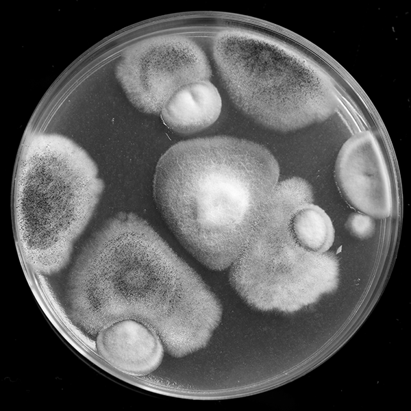 petri dish with culture of microorganisms